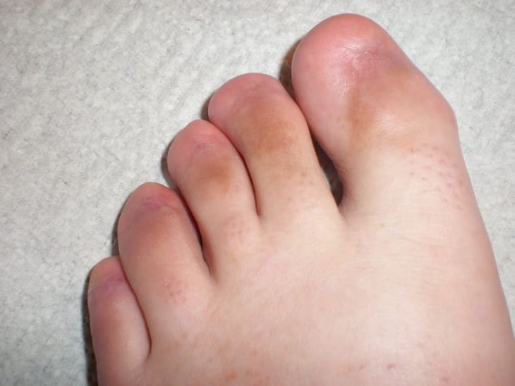 pies repugnantes sin u&ntilde;as