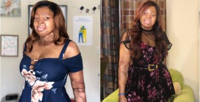Kechi Okwuchi sobrevivió a un accidente aéreo y ahora triunfa como cantante
