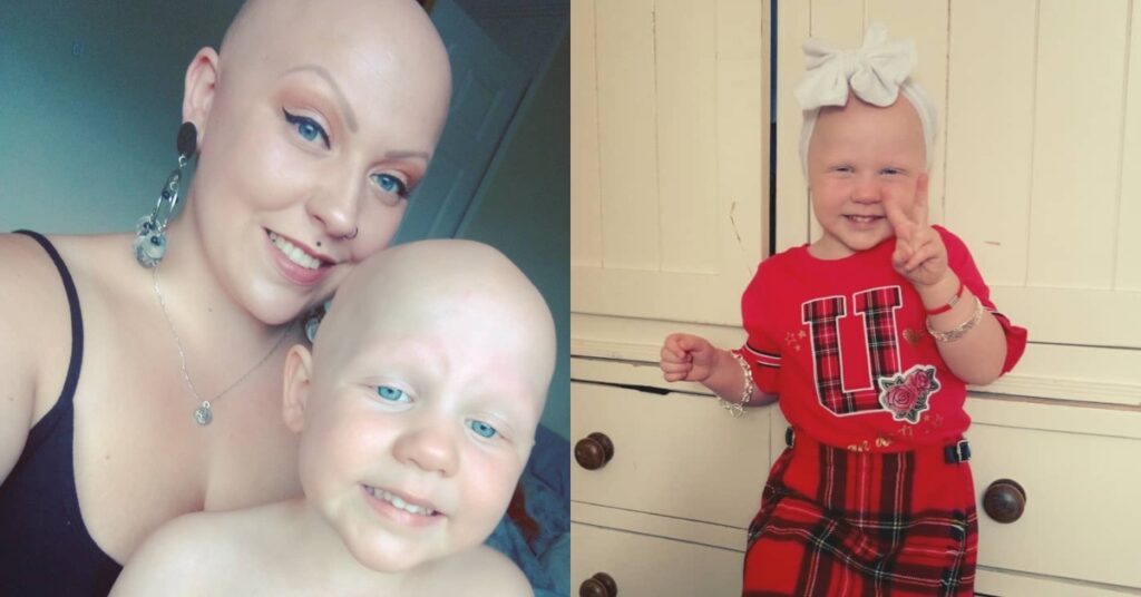 Madre e hija con alopecia nos enseñan una lección de amor propio
