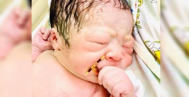 La sorprendente historia del bebé que nació con el DIU de su madre