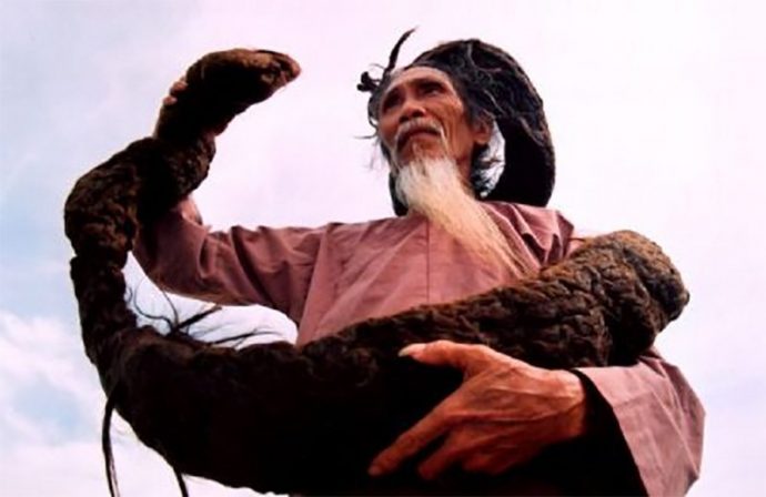 20 personas con las anomalías más extrañas del planeta