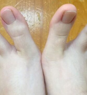 El mundo entero esta obsesionado con los Pies de esta mujer banner